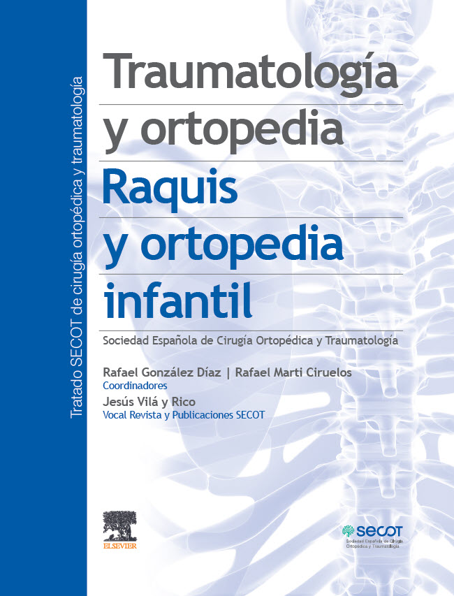 Expertos presentan las novedades en Traumatología y Ortopedia del Raquis y Ortopedia Infantil en el último Tratado SECOT